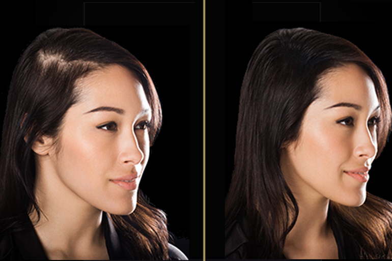 15 Best Ways to Stop Hair Fall Natural at Home