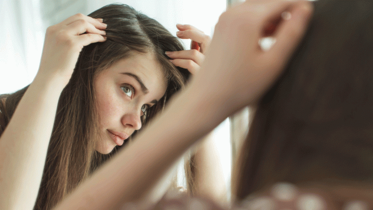 8 Effective Home Remedies to Stop White Hair Naturally