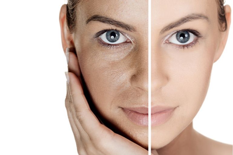 How To Get Rid Of Open Pores For A Brighter Skin